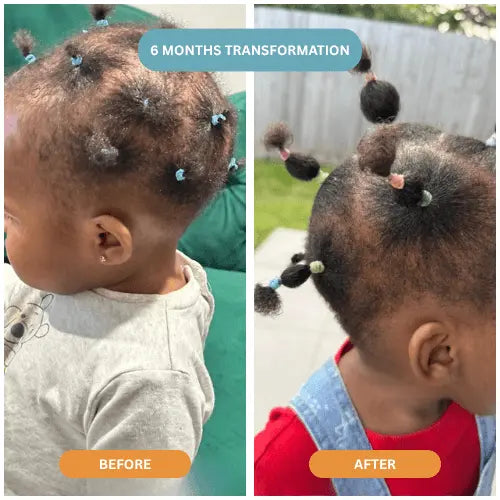 Herbal Hair Growth Oil