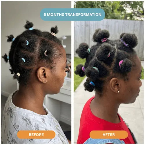 Herbal Hair Growth Oil