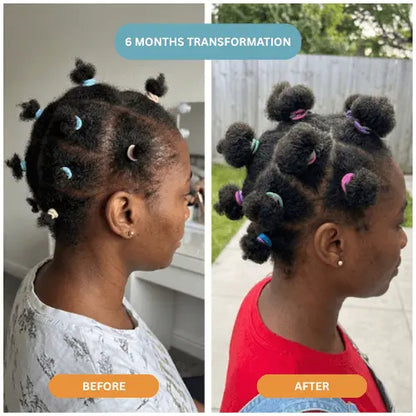 Herbal Hair Growth Oil